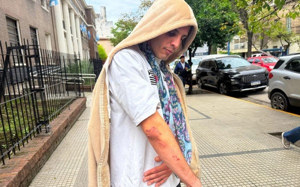 El joven agredido a la salida de un boliche habló y pidió que avance la investigación
